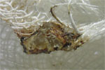 http://www.mblusuk.com/gambar/verruca.jpg